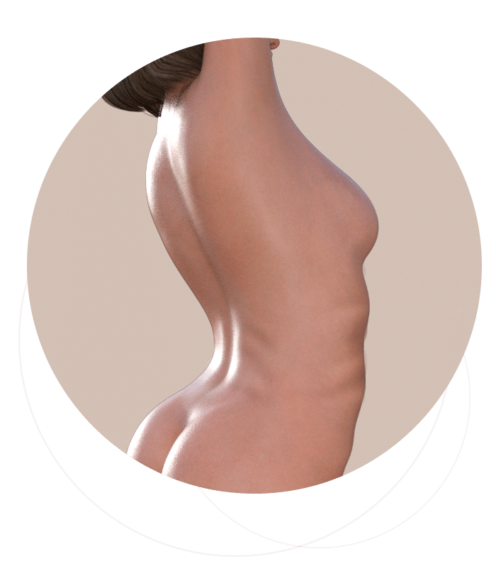 Lipoaspiração Lipoescultura Lipoenxertia enxerto de gordura