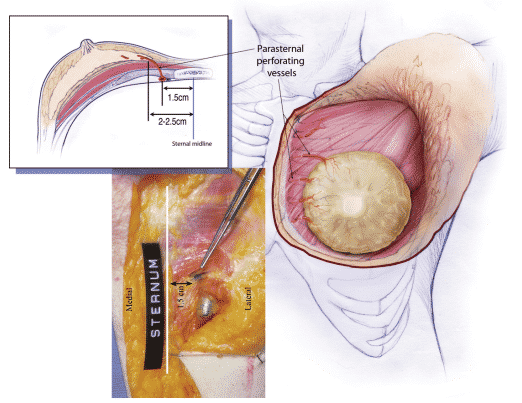 Hemostasia Prospectiva